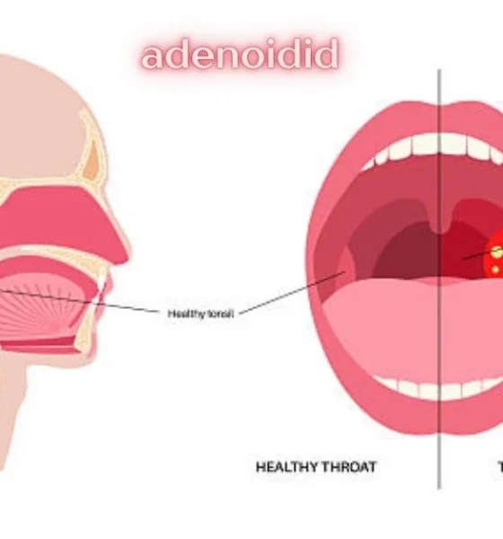 adenoidid